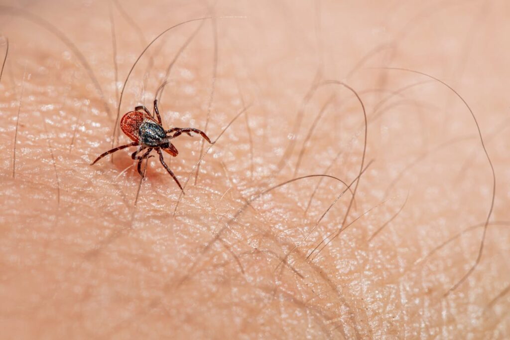 Lyme Disease Travel Guide