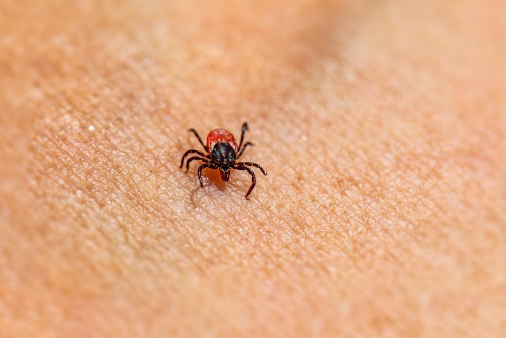 Tick bite travel health close up of tick attached to human skin